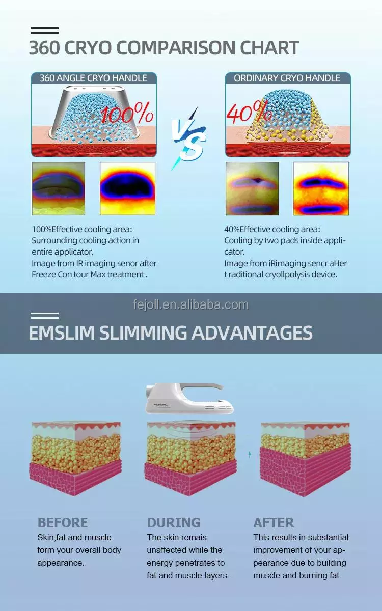 360 cryo comparison chart