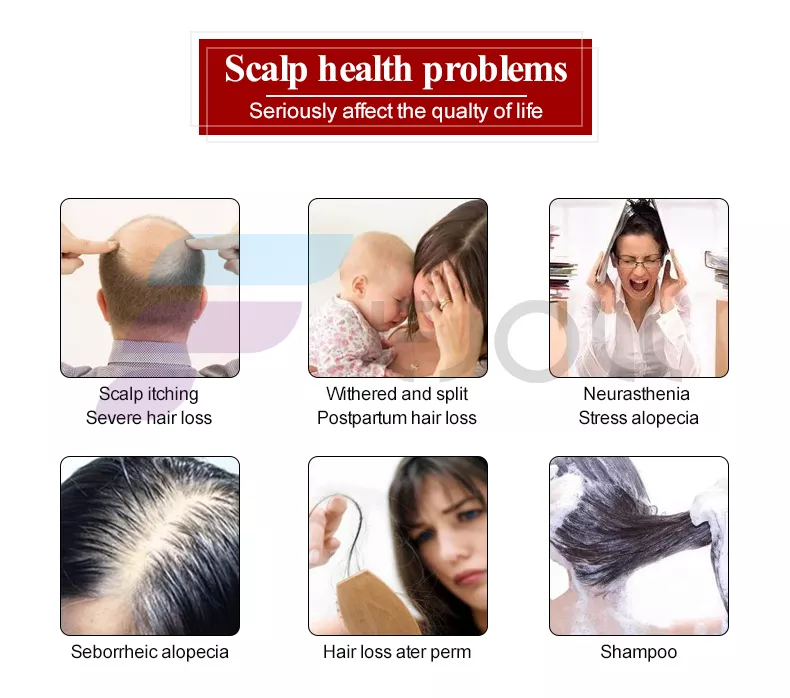 scalp health problems