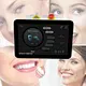 YUWEI Potenziale elettrico Laser di sinterizzazione Macchina odontoiatrica Suggerimenti Laser dentale per tessuti molli a diodi