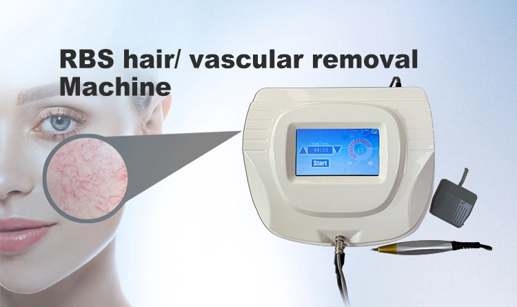 RBS vascular removal