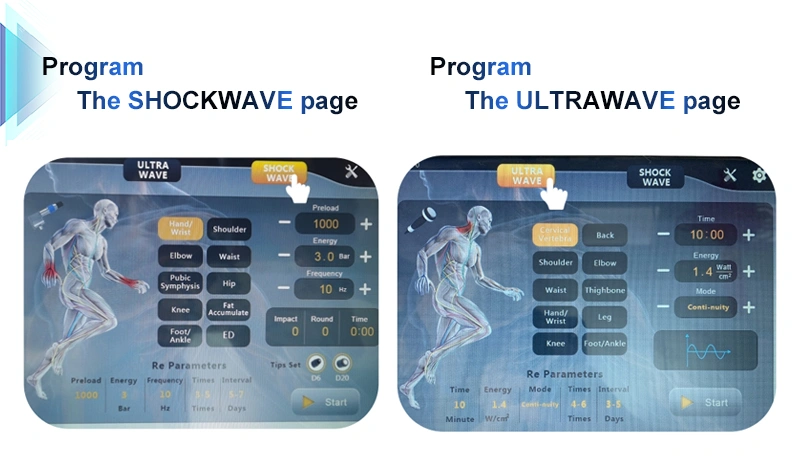 Shock wave
