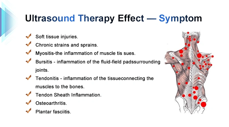 Soft tissue injuries