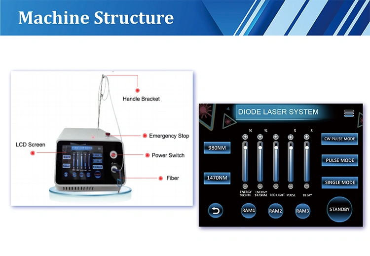 Laser Varicose Veins Treatment