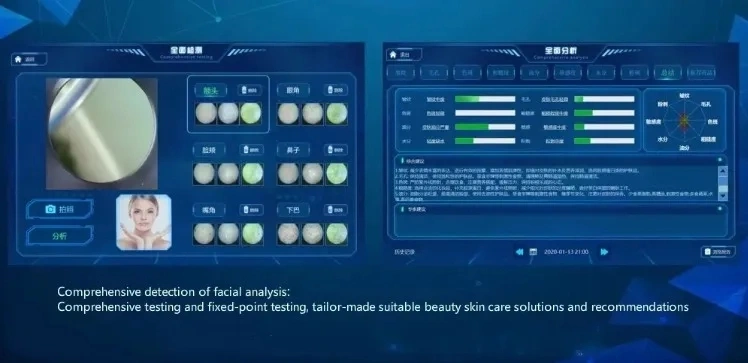 Ultrasonic head