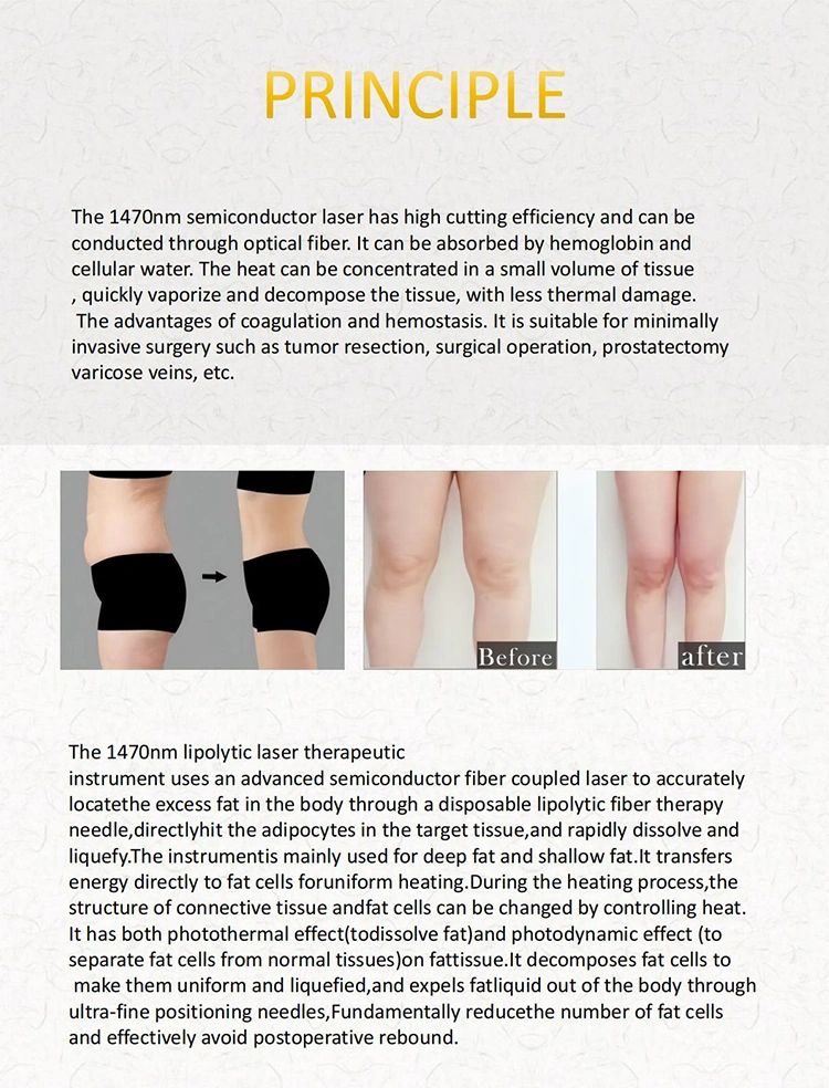 lipolysis