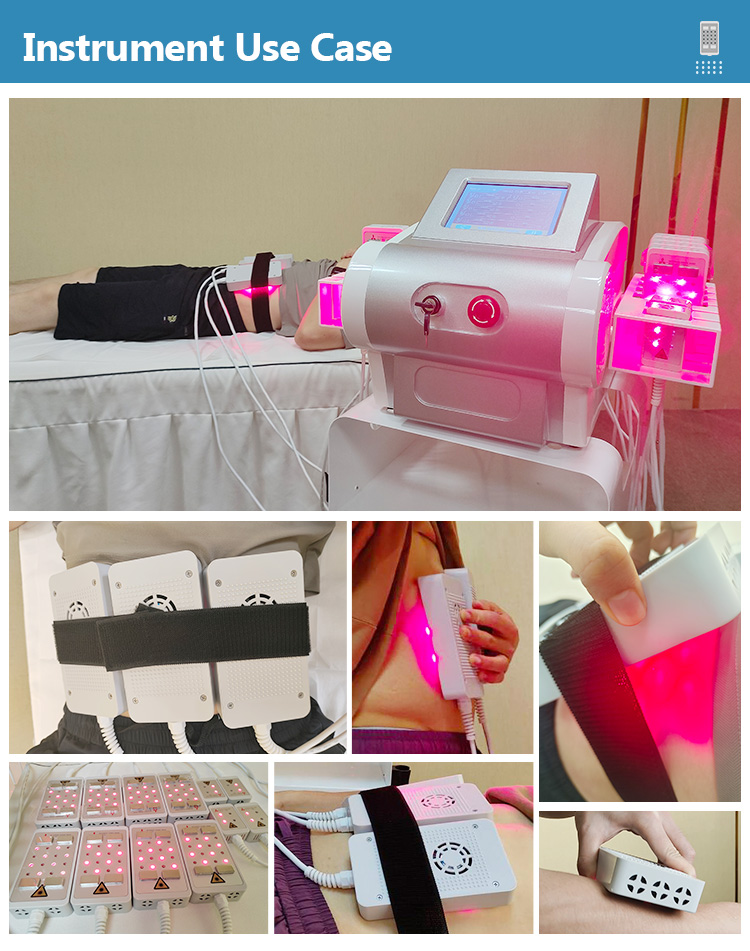 lipo laser