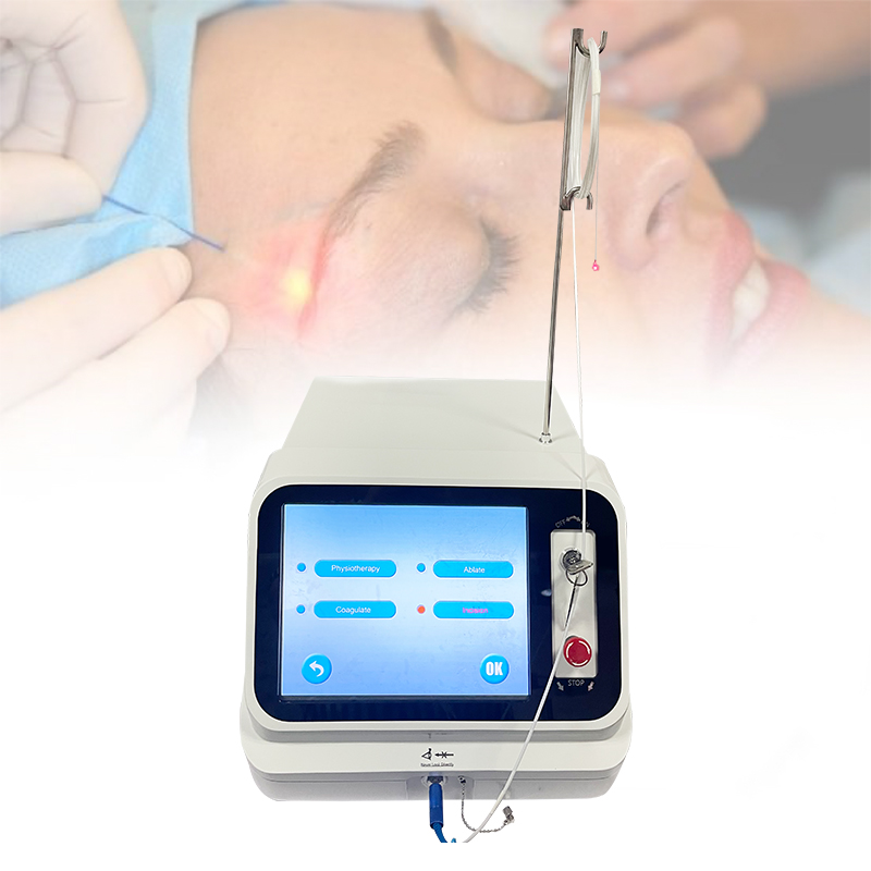 laser lipolysis