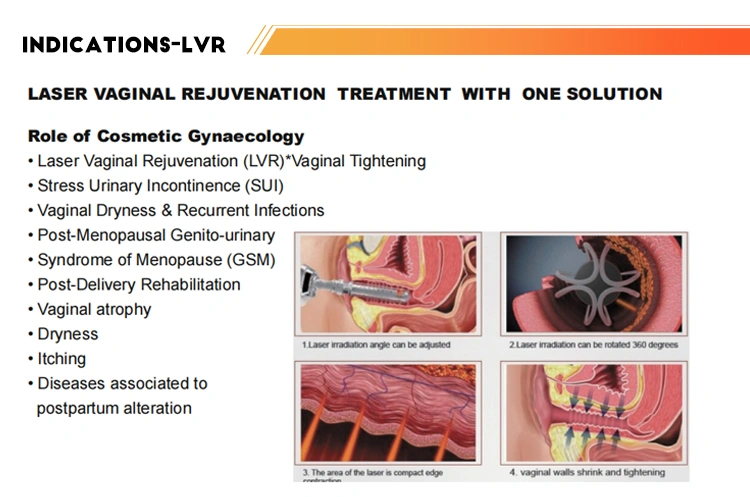 Vaginal Atrophy