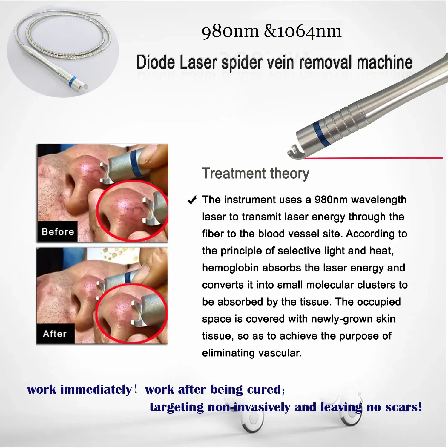 980nm 1064nm Diode Laser