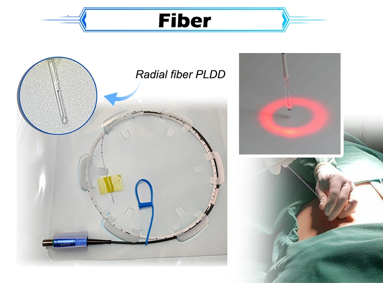 radial fiber pldd