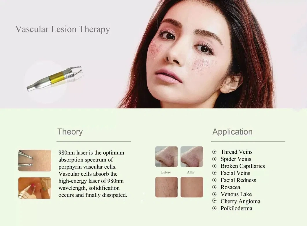 980nm Liposuction