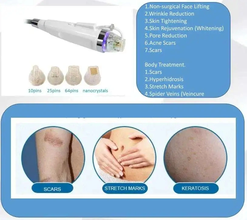 microneedle rf