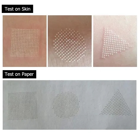 co2 fractional laser