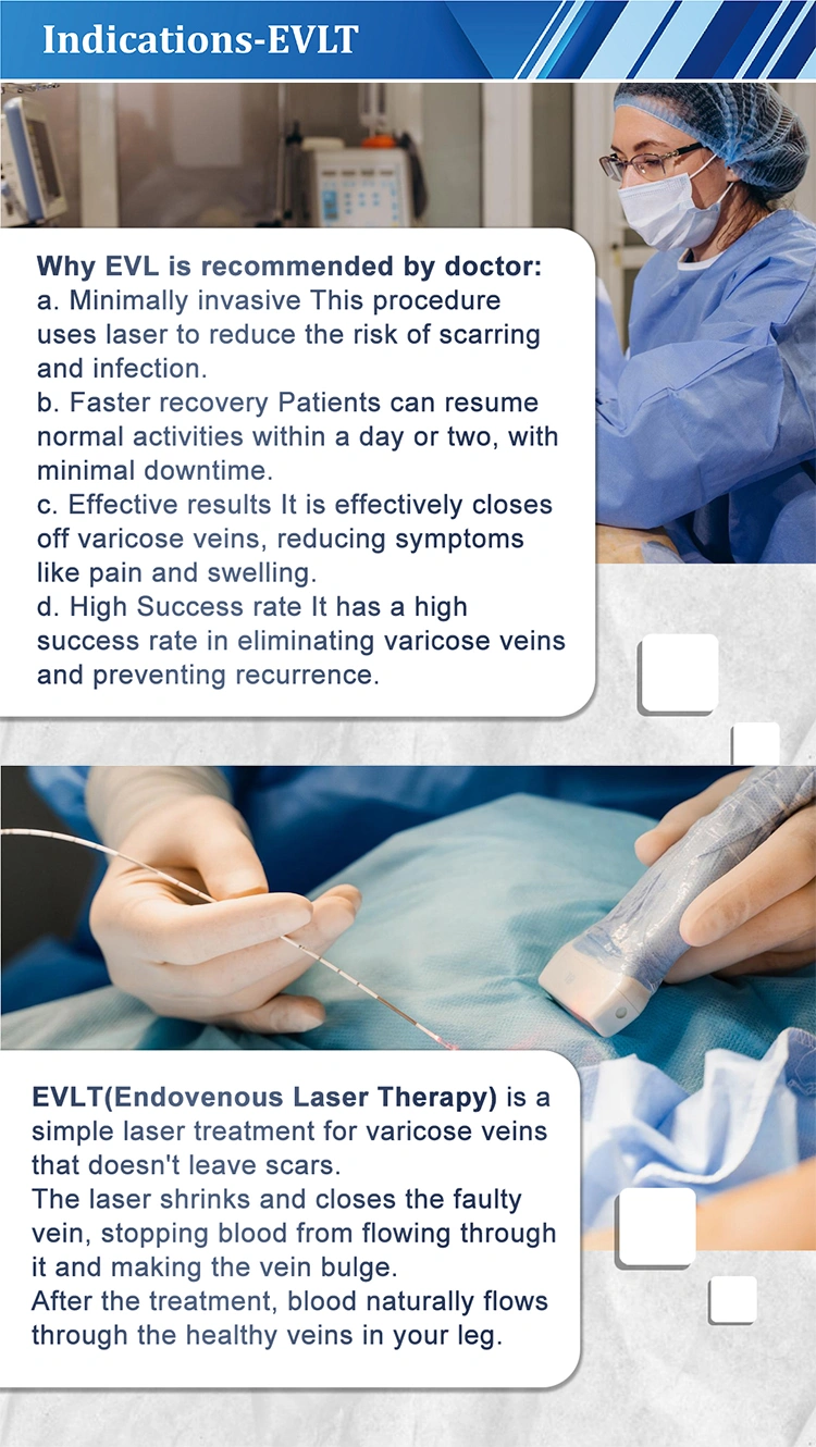 evlt endovenous laser