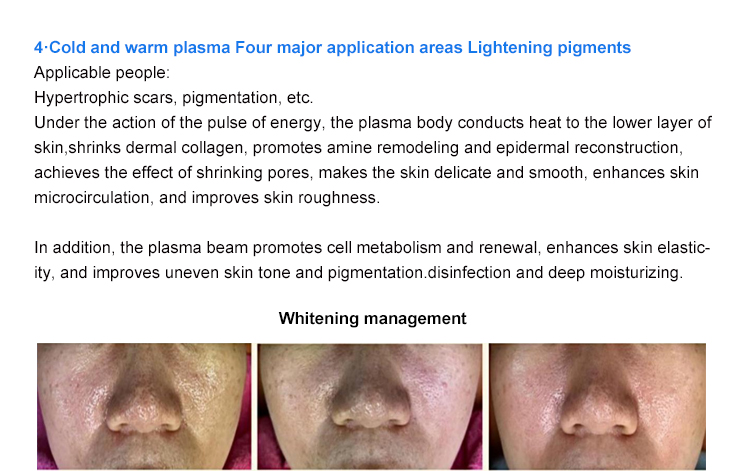 Skin Tightening Wrinkle Removal Lifting Jet Beauty Plasma Equipment