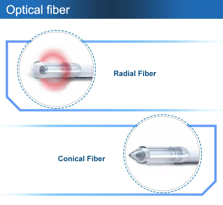 Hemorrhoidectomy optical fiber