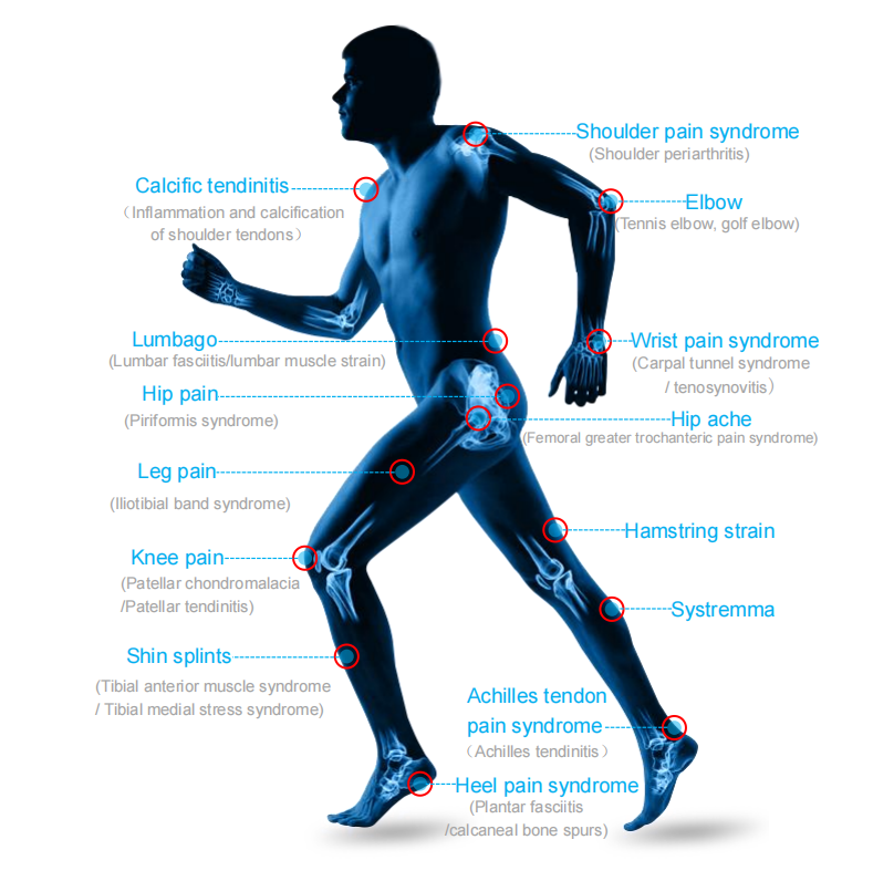 Chronic Pain Relief