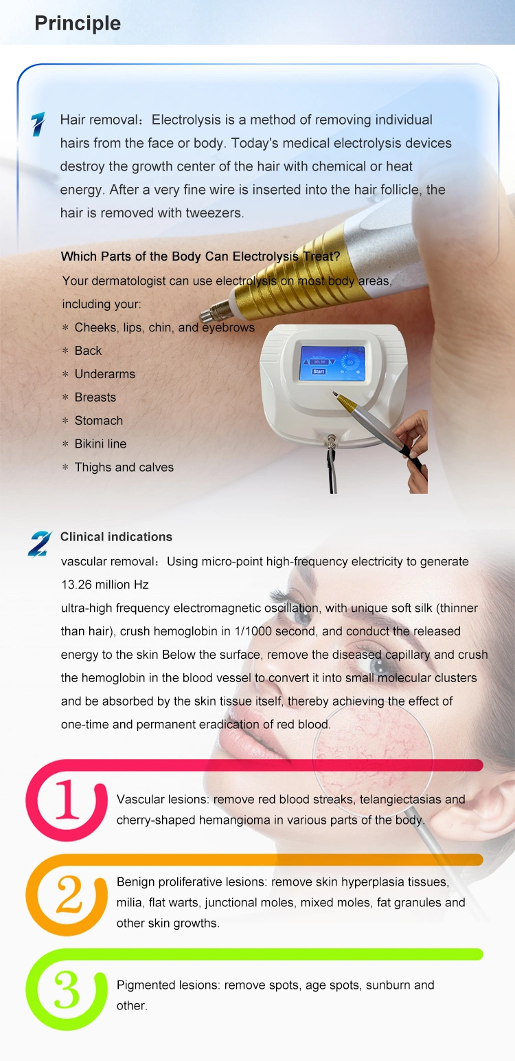 RBS vascular removal