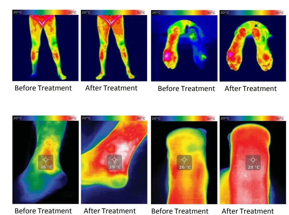 Magnetic Field Therapy