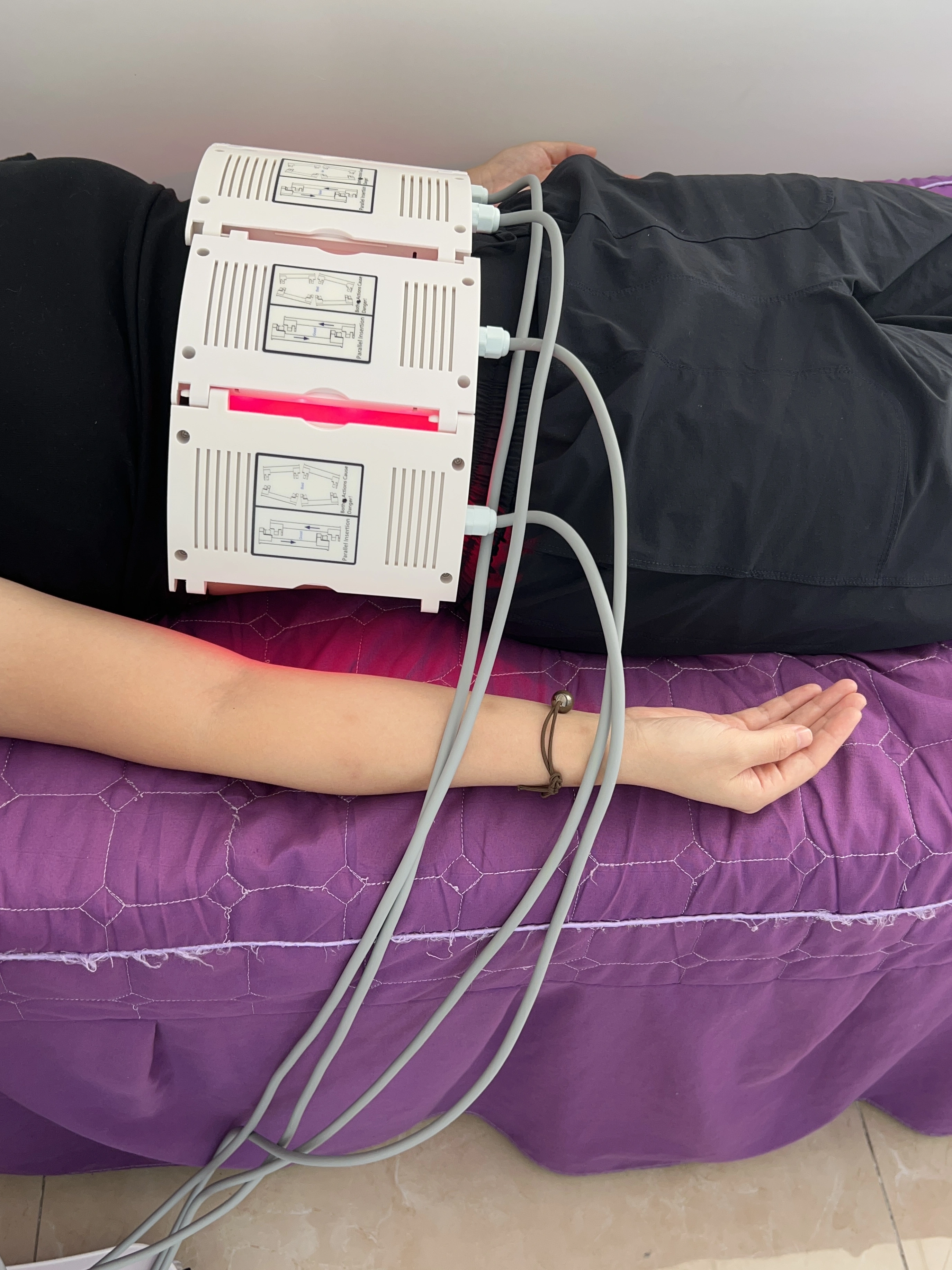 lipo laser