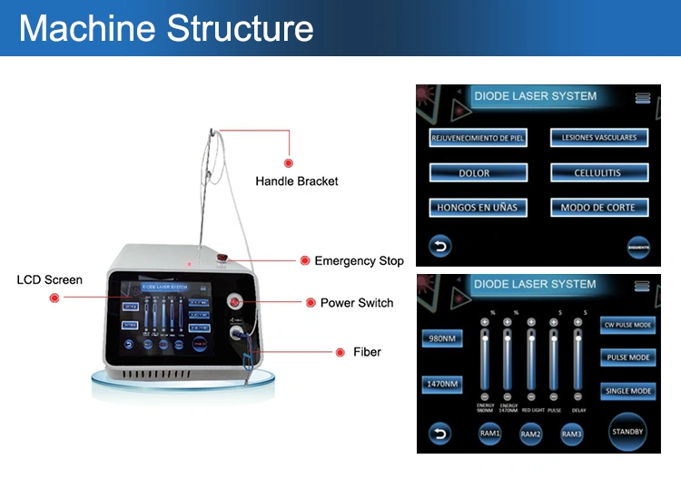 980 nm diode laser
