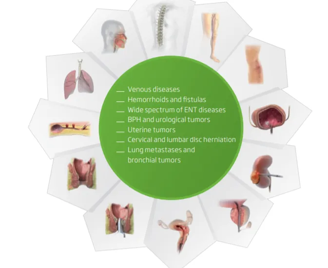 surgery hemorrhoidectomy devic