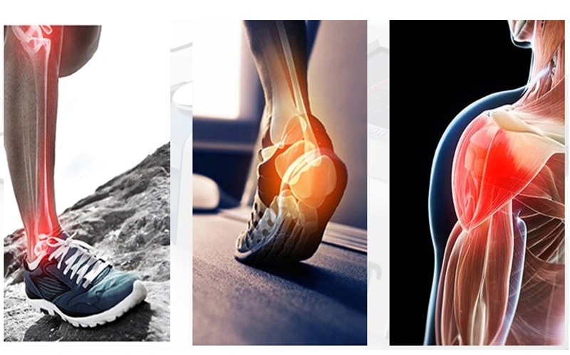 physiotherapy