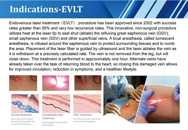 endolaser diodo 980 nm 1470nm laser
