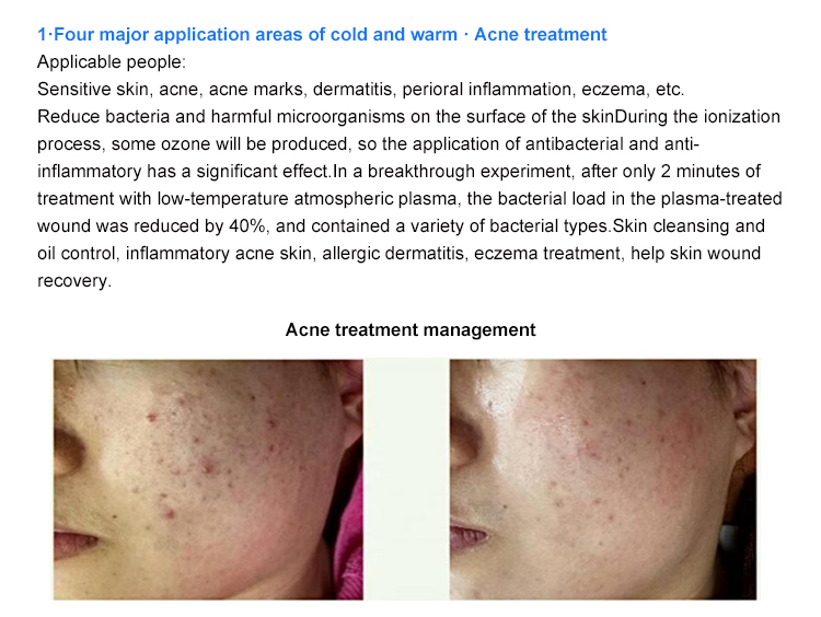 Beauty Plasma Equipment