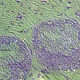 Inverted Fluorescent Biological Microscope
