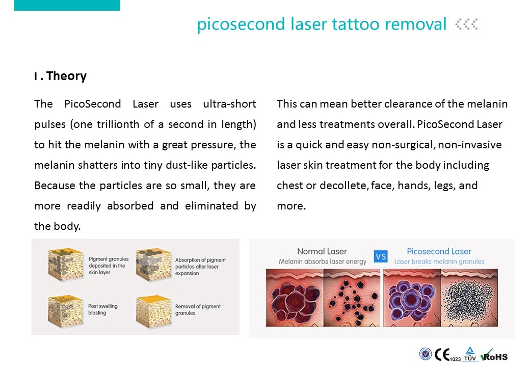 Picosecond Laser