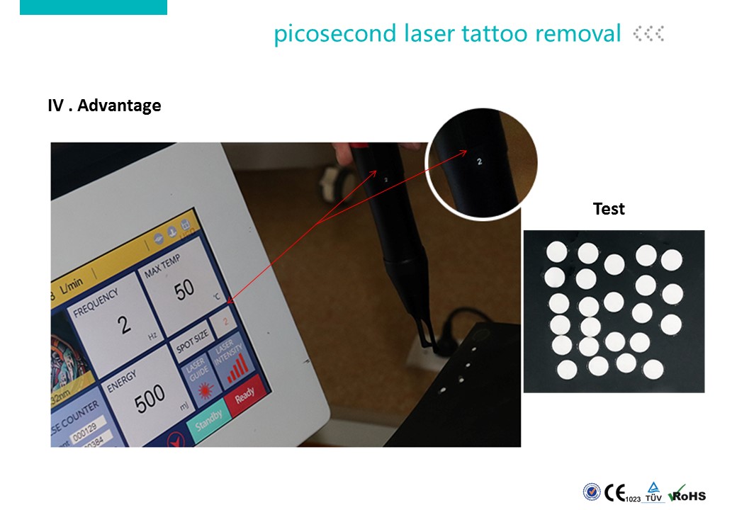 Carbon Laser Peeling Machine