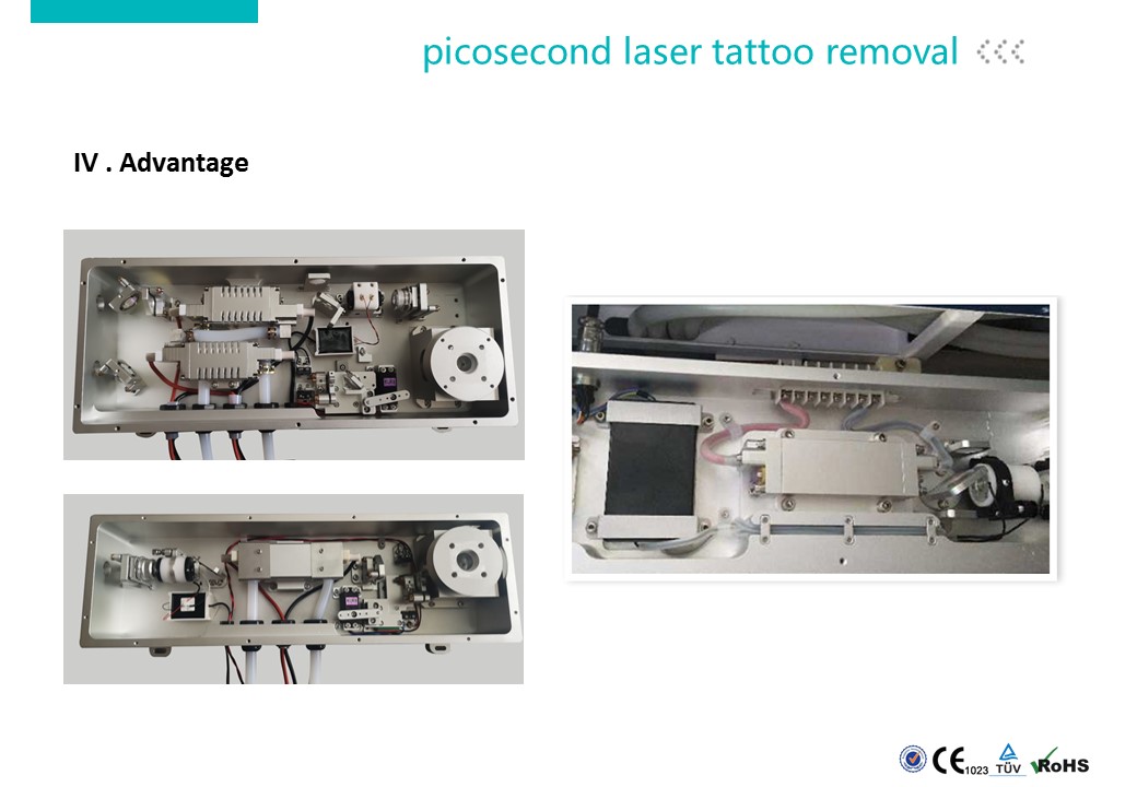 Carbon Laser Peeling Machine