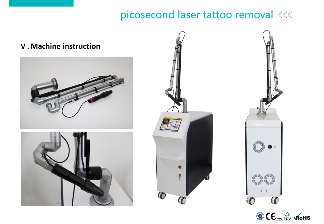 Carbon Laser Peeling Machine