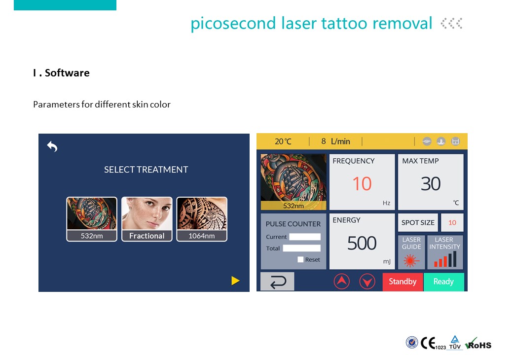Carbon Laser Peeling Machine