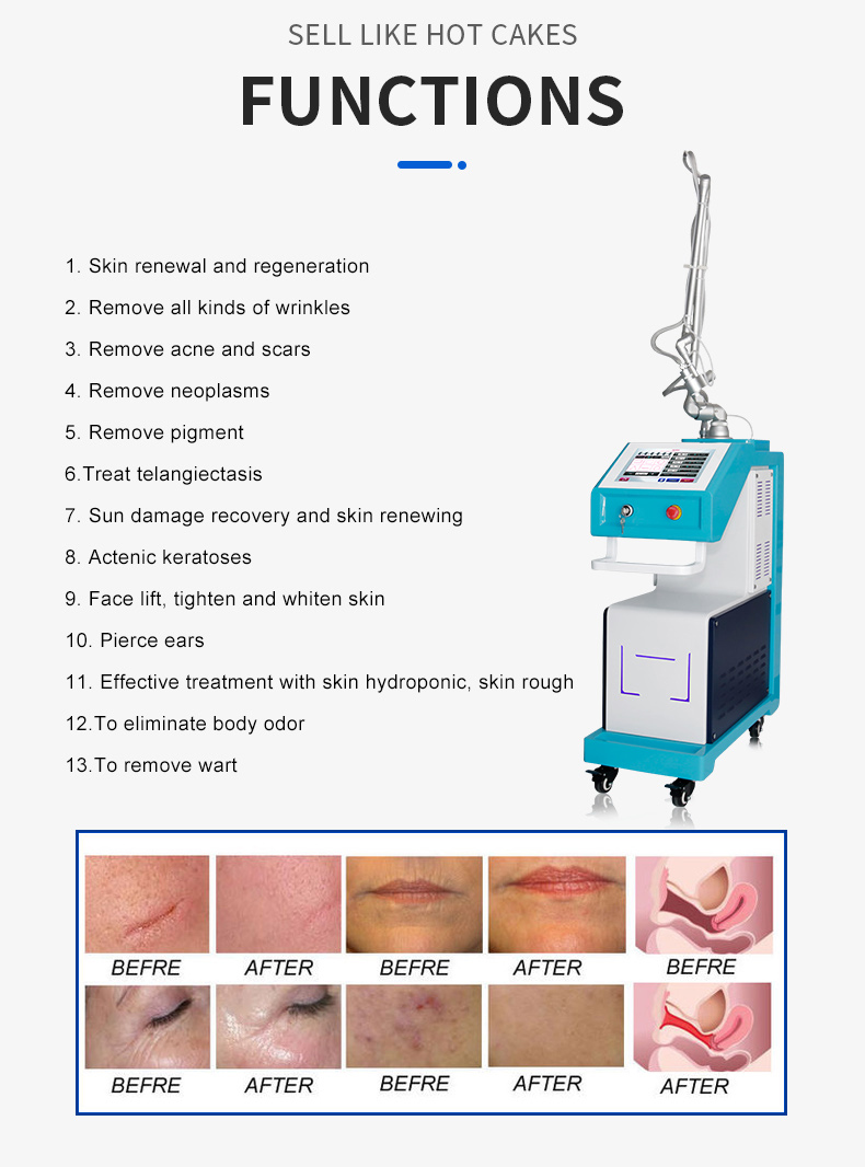 Co2 Fractional Laser Machine