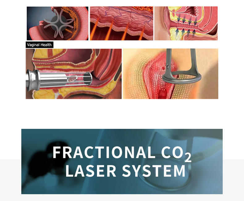 Co2 Fractional Laser Machine