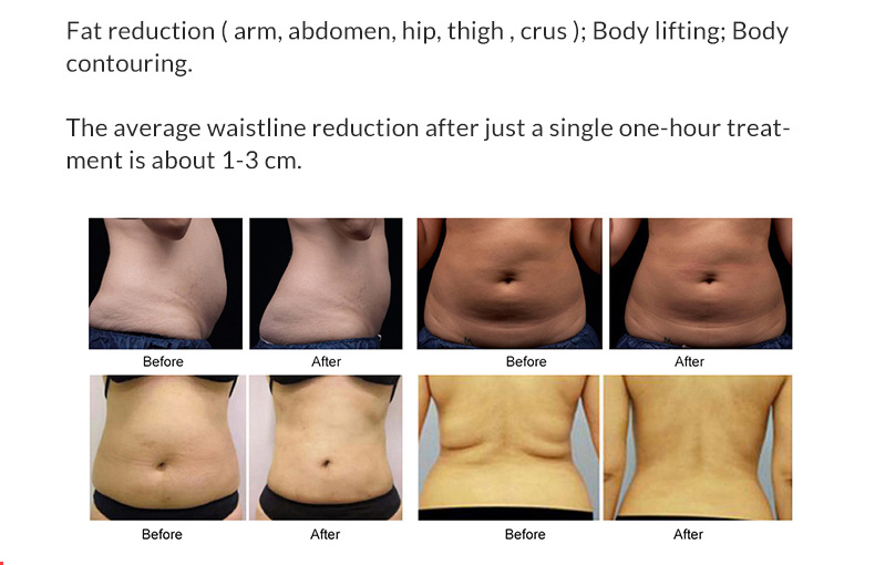Weight Loss Machine