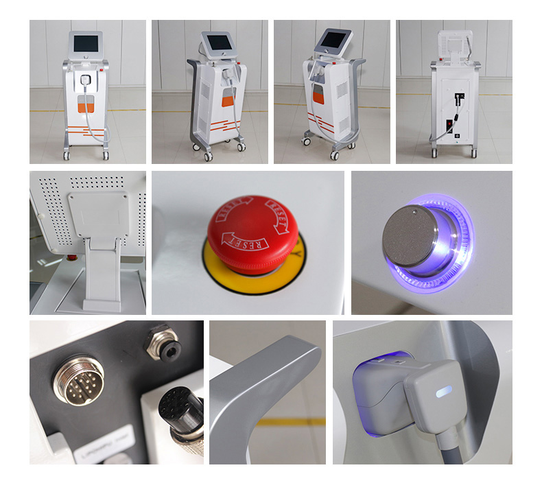 Liposonix Machine
