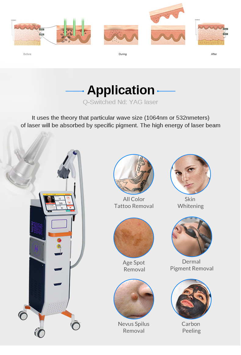 Nd yag laser