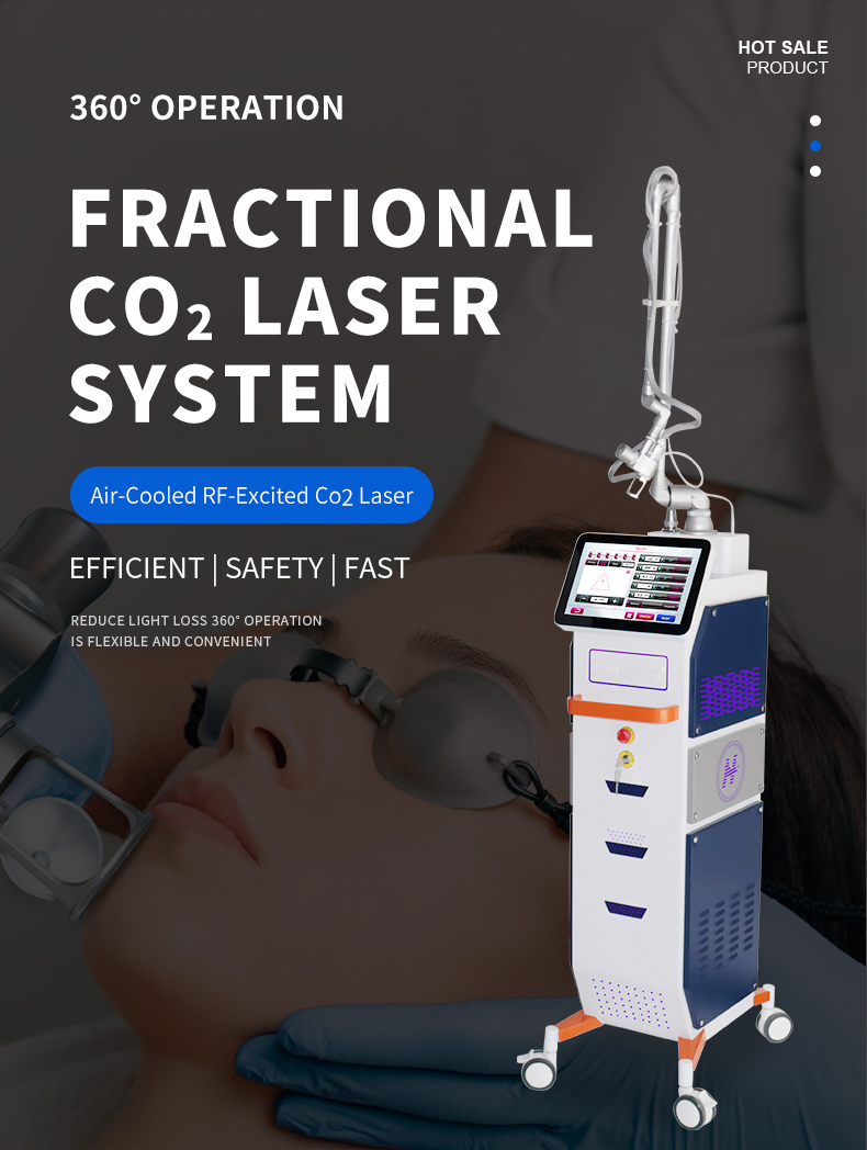 nd yag laser