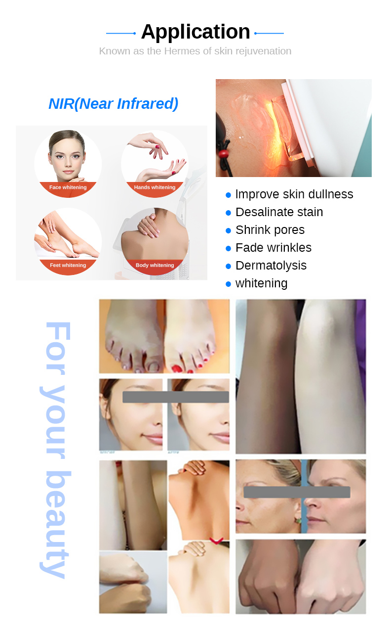Skin Rejuvenation Equipment