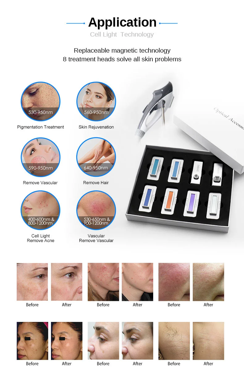 IPL Laser Hair Removal Machine