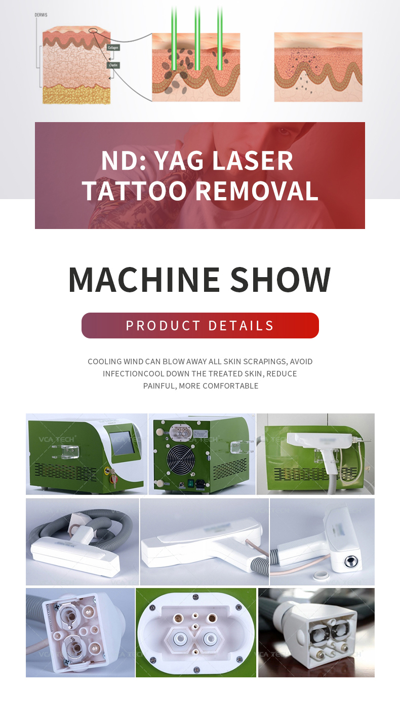 q switch ND YAG laser