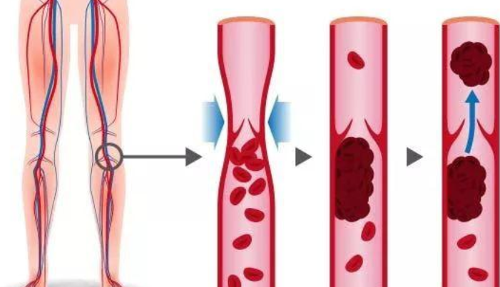 What is Serrapeptase Good For?