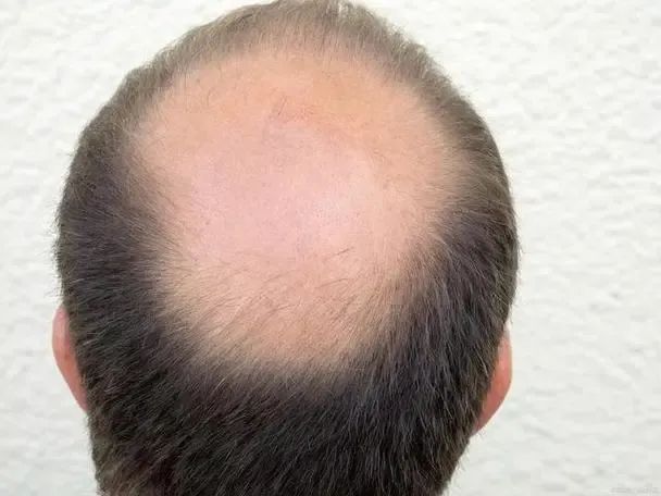 Enhancing Hair Follicle Stem Cell Activity