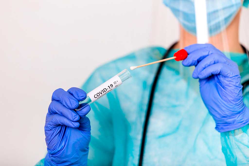 COVID-19 and PCR Testing
