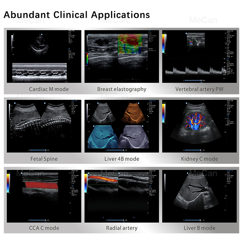 Trolley Ecografo 3D 4D Ultrasound Machine with LED Monitor 8