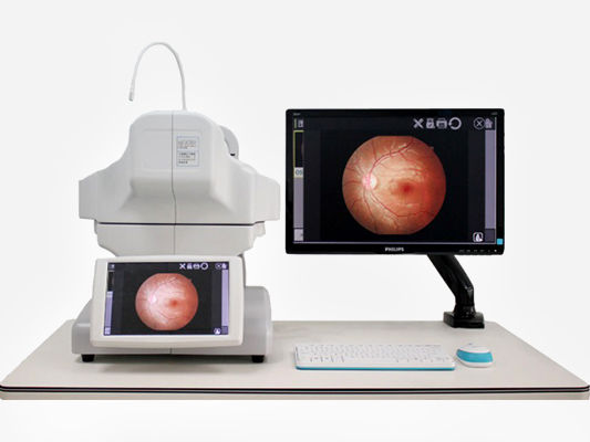 The First Auto Non-mydriatic Fundus Camera Made In China
