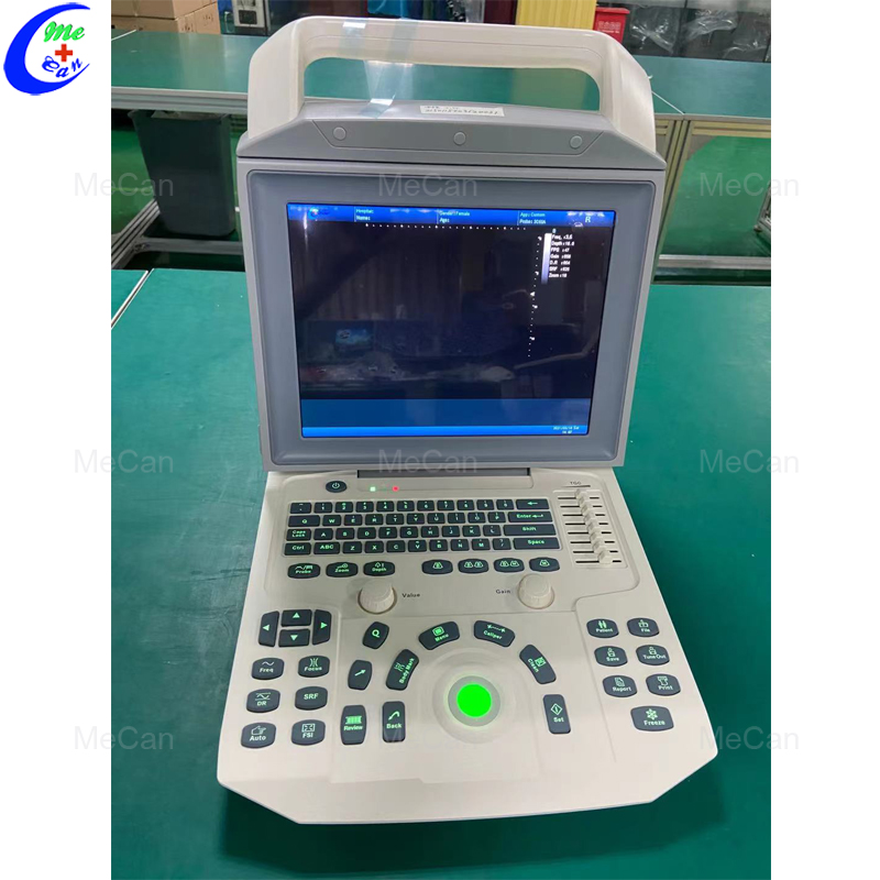 Medical Portable Full Digital Black And White Ultrasound Machine 10